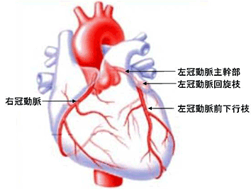 冠動脈の図